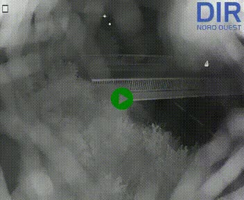 Webcam sur A84 à hauteur de Pont-Farcy, au niveau du pont autoroutier sur la Vire, au sud de Saint-Lô