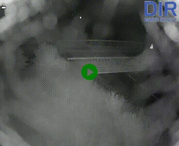 Webcam sur A84 à hauteur de Pont-Farcy, au niveau du pont autoroutier sur la Vire, au sud de Saint-Lô